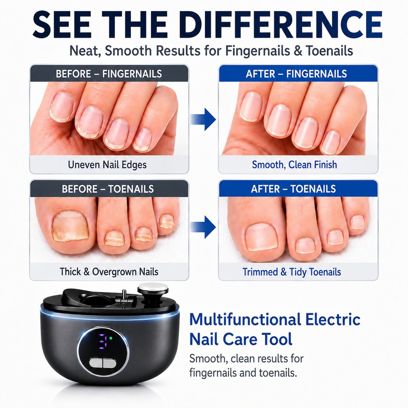 Before and after trimming fingernails and toenails with a rechargeable electric nail clipper